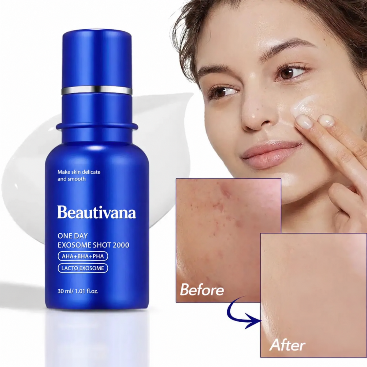 Beautivana One Day Exosome Shot 2000 skincare bottle in blue, shown next to a woman applying cream to her face, with a before-and-after skin texture comparison inset.