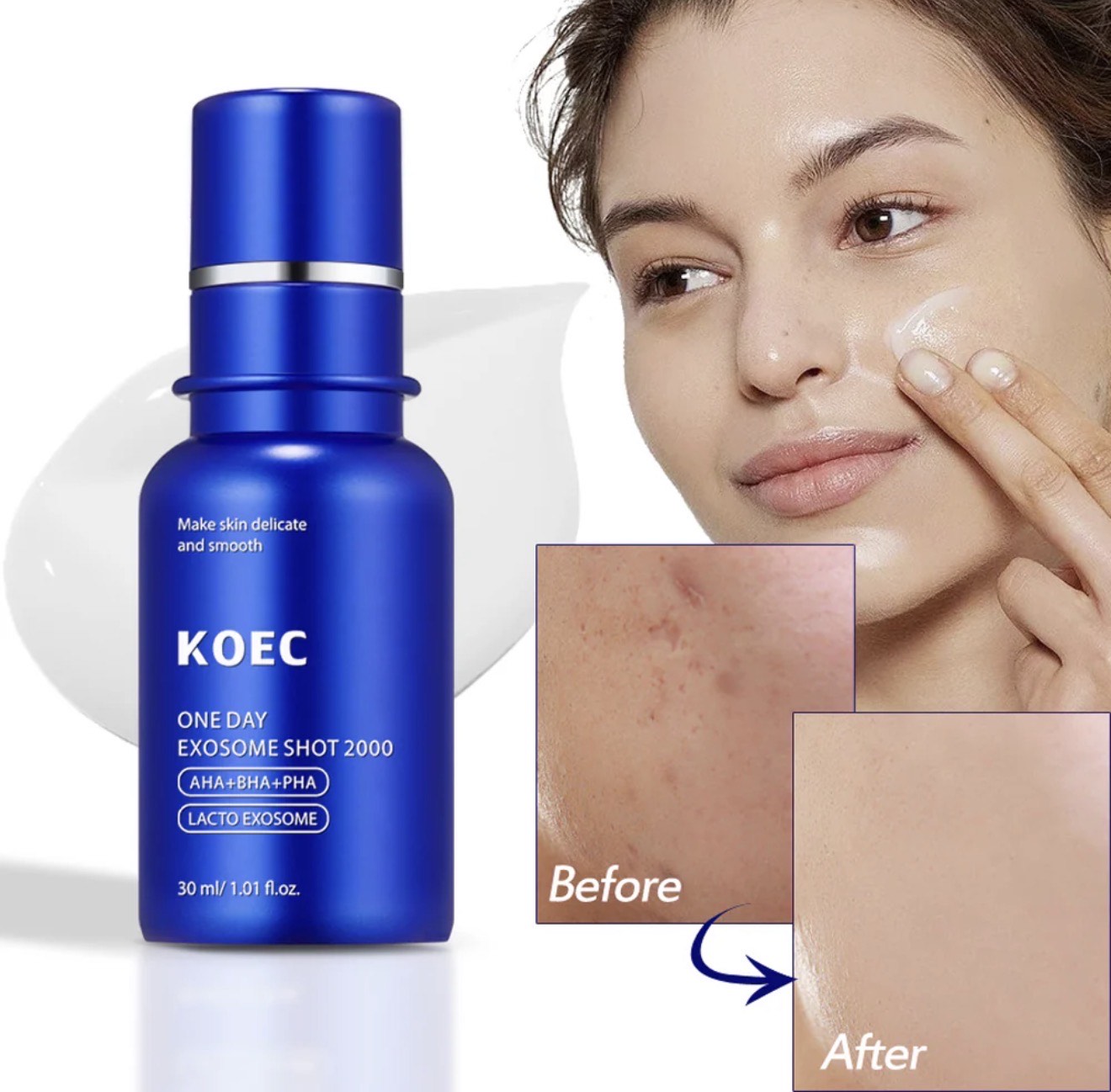 KOEC One Day Exosome Shot 2000 – Intensive Pore Tightening & Skin Renewal Serum with AHA, BHA, PHA