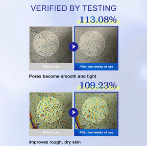 KOEC One Day Exosome Shot 2000 – Intensive Pore Tightening & Skin Renewal Serum with AHA, BHA, PHA