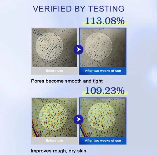 "Comparison images showing skin texture before and after using KOEC One Day Exosome Shot, with highlighted pore details."