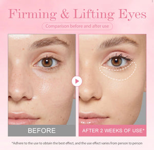 KOEC Bomb Lifting Eye Gel with Retinol, Collagen & Niacinamide – Firming & Brightening Under Eye Care