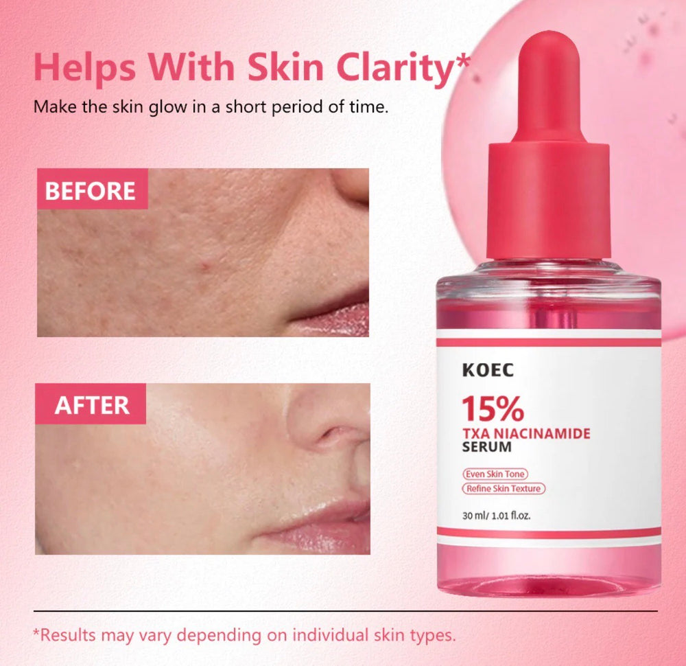 KOEC 15% TXA Niacinamide Serum – Brightening & Hydrating Serum for Even Skin Tone | 30ml