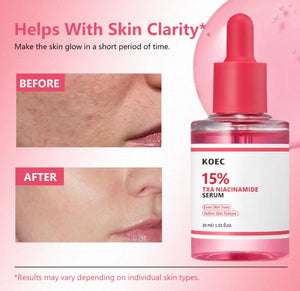 KOEC 15% TXA Niacinamide Serum – Brightening & Hydrating Serum for Even Skin Tone | 30ml