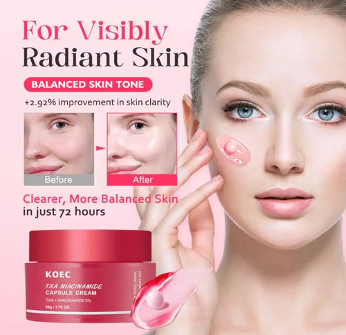 "KOEC TXA Niacinamide cream in a red jar with a pink lid, shown alongside a model applying the cream to her face."