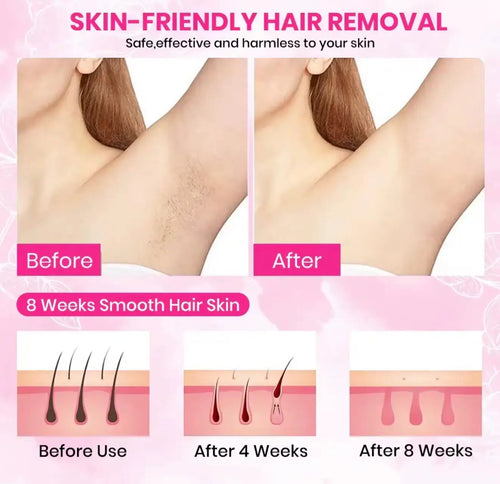 Before and after images of underarm hair removal; left shows hair, right shows smooth skin, with hair growth stages below.