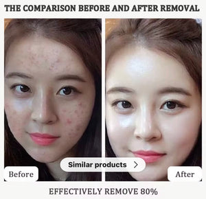 KOEC Exfoliant Rice & Black Rice Ampoule Duo – Radiance & Texture Repair (100 mL each)