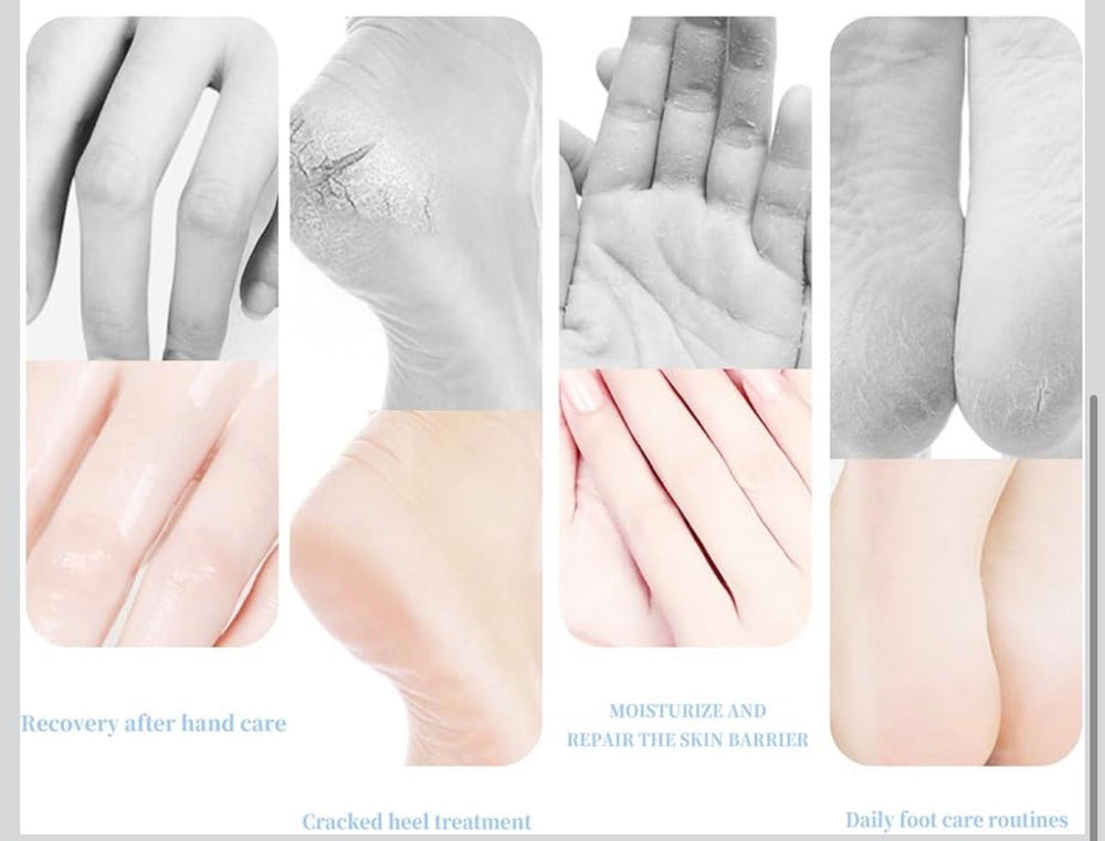 Hydrating & Moisturizing Hand and Foot Care Stick – Deep Repair for Cracked Heels & Dry Skin