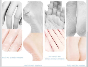 Hydrating & Moisturizing Hand and Foot Care Stick – Deep Repair for Cracked Heels & Dry Skin