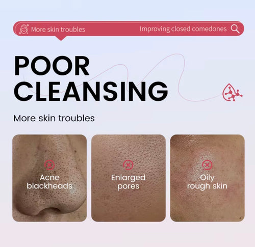 Beautivana 3-Piece Deep Cleansing Mud Mask Stick Set