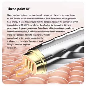 WaveClean Eye Beauty Device – RF, EMS, LED Therapy for Wrinkles