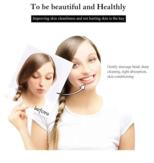 "Before and after image of a woman with clear skin on the right, showing a smiling expression and long hair, holding a photo.