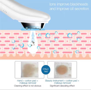 Ultrasonic Skin Rejuvenation Device Device | Multi-Function Skin Care Tool for Anti-Aging and Moisturizing