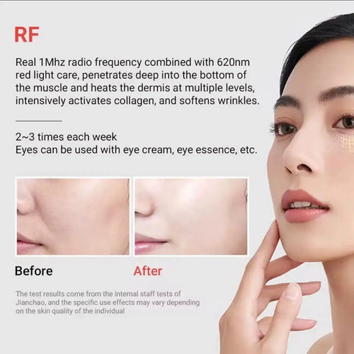 "White RF & EMS skin tightening device with silver accents, featuring a rounded head and ergonomic handle, on a light backgro