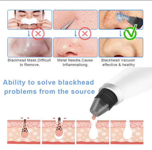 Pore vacuum targeted facial pore care and cleansing illustration