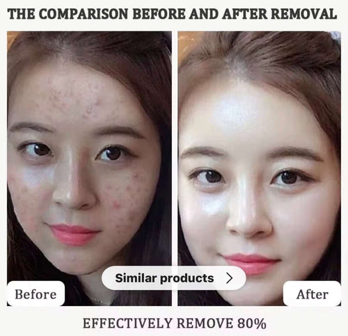 Beautivana Rice and Black Rice facial ampoule set
