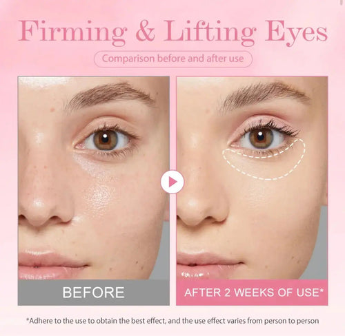 Beautivana Under-Eye Gel with Retinol Collagen and Niacinamide