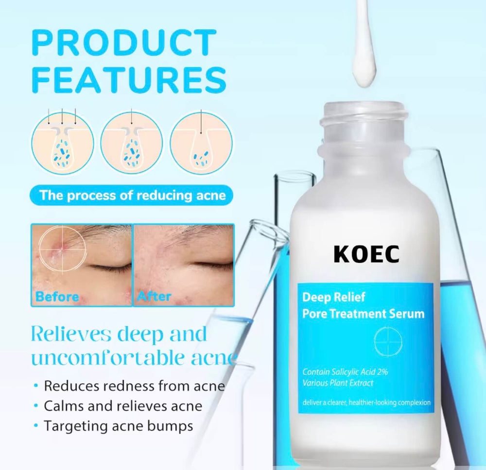 Deep Relief Pore Treatment Serum – 2% Salicylic Acid Acne & Pore Care - Beautivana
