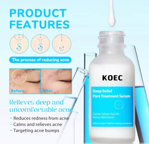 Deep Relief Pore Treatment Serum – 2% Salicylic Acid Acne & Pore Care - Beautivana