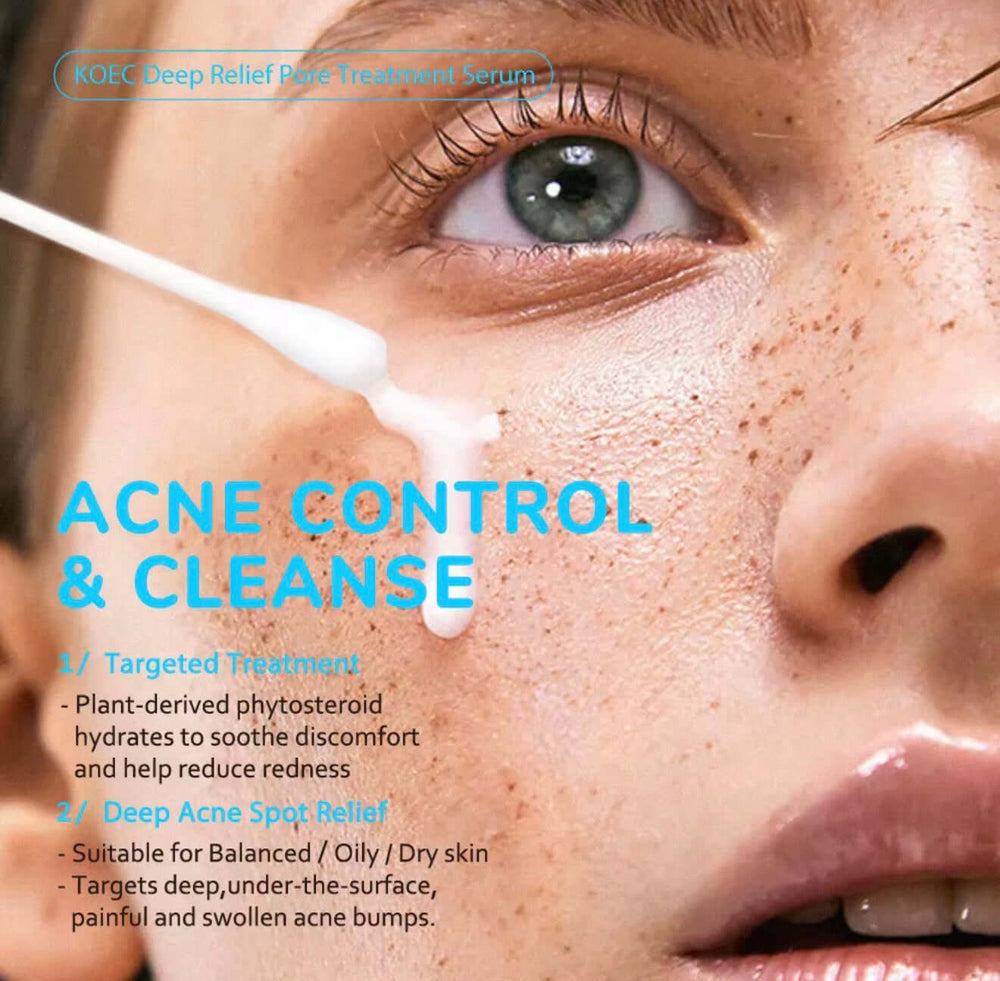 Deep Relief Pore Treatment Serum – 2% Salicylic Acid Acne & Pore Care - Beautivana