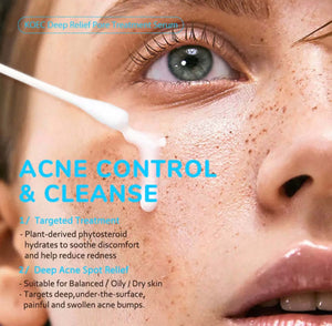 Deep Relief Pore Treatment Serum – 2% Salicylic Acid Acne & Pore Care - Beautivana