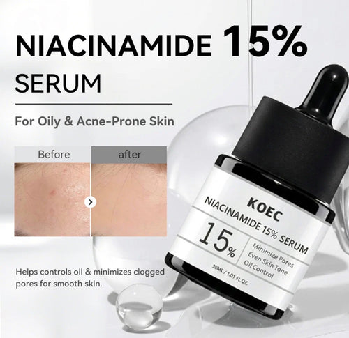 KOEC Niacinamide 15% Serum for oily skin routines