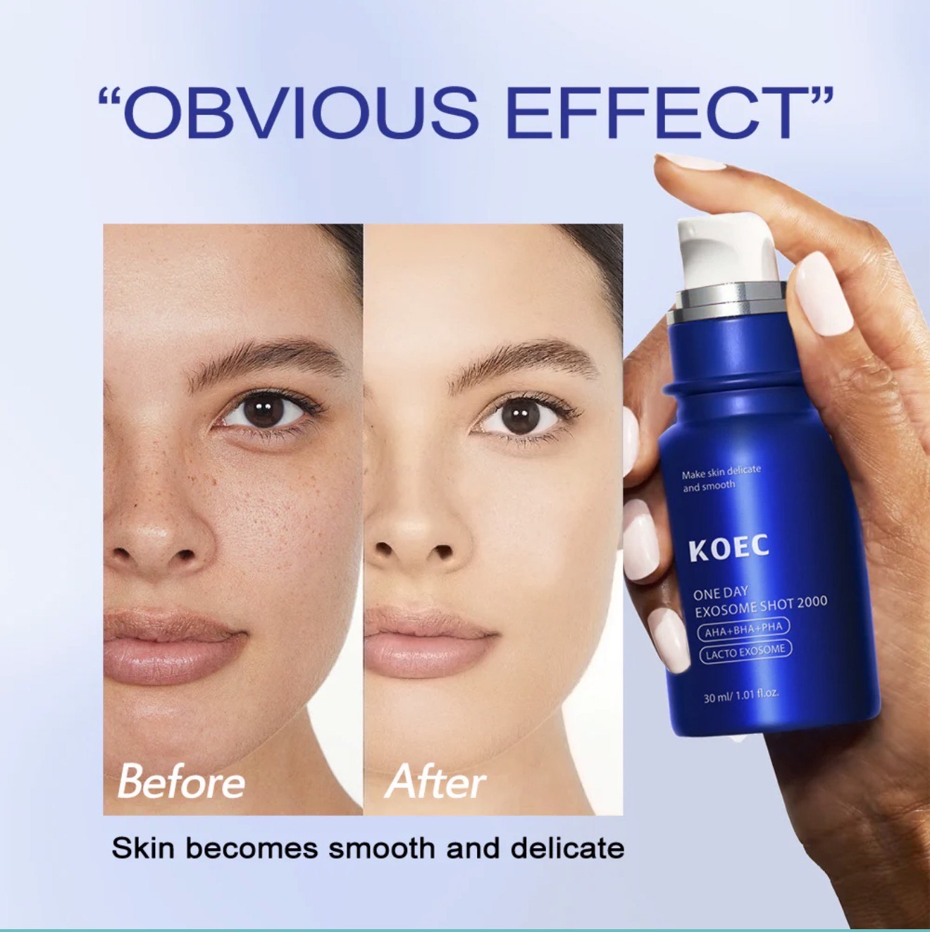 KOEC One Day Exosome Shot 2000 – Intensive Pore Tightening & Skin Renewal Serum with AHA, BHA, PHA - Image 2